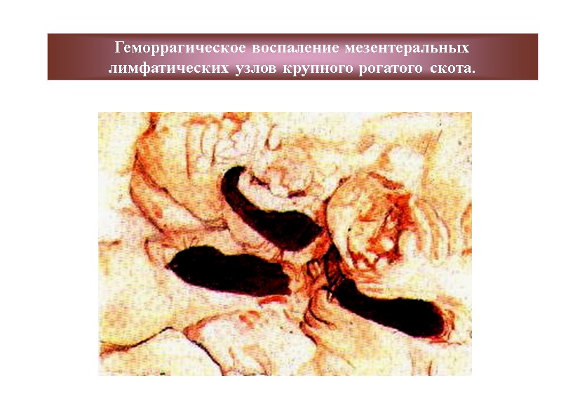 Геморрагическое воспаление мезентеральных лимфатических узлов крупного рогатого скота.